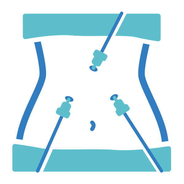 Gynae Laparoscopic Surgeon